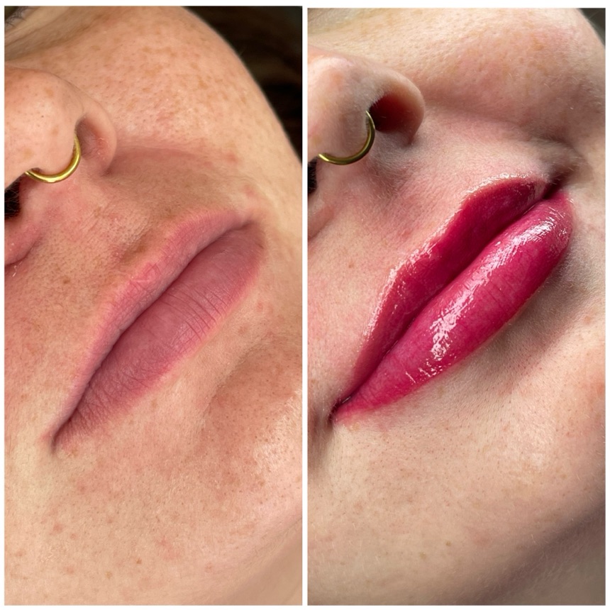 Før og efter — PMU lip blush, naturlig læbefarve hos DARVILLE
