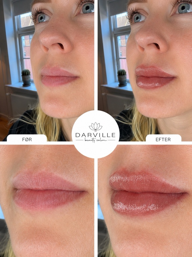 Før og efter permanent makeup lip blush